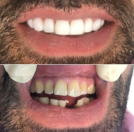 نمونه کار زیبایی