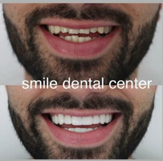 نمونه کار زیبایی