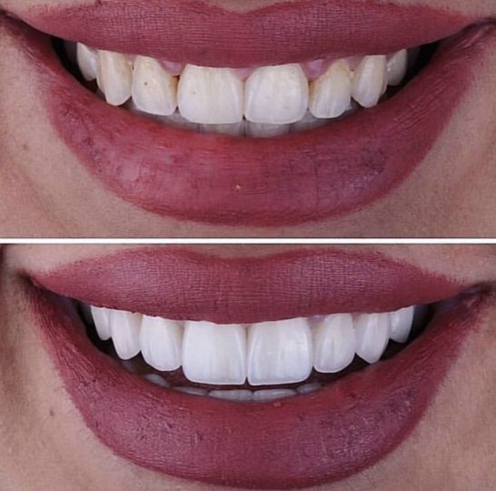 نمونه کار زیبایی