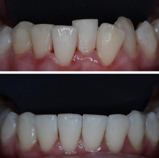 نمونه کار زیبایی