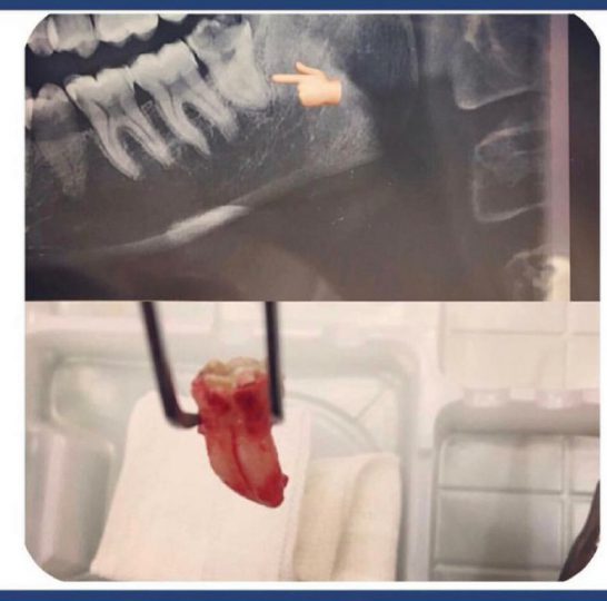 نمونه کار جراحی