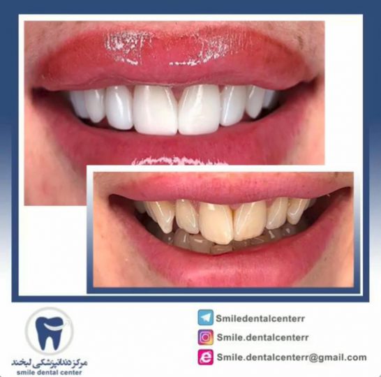 WhatsApp Image 2019-12-14 at 13.12.21 (1)