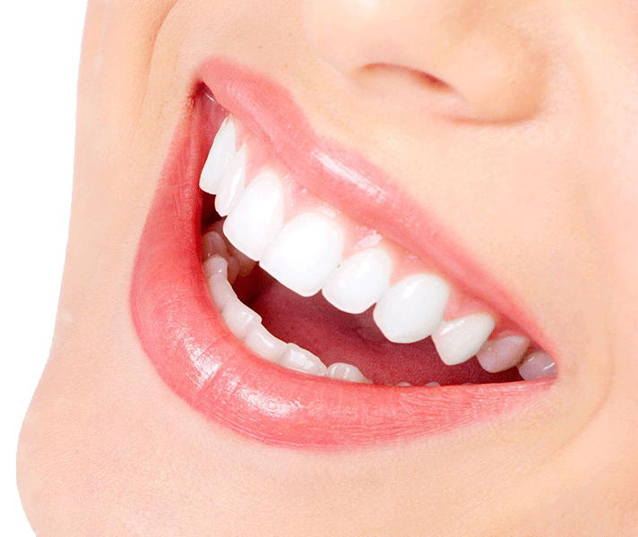 دندان پزشکی در سعادت آباد دندان پزشکی لبخند مرکز دندان پزشکی در سعادت آباد